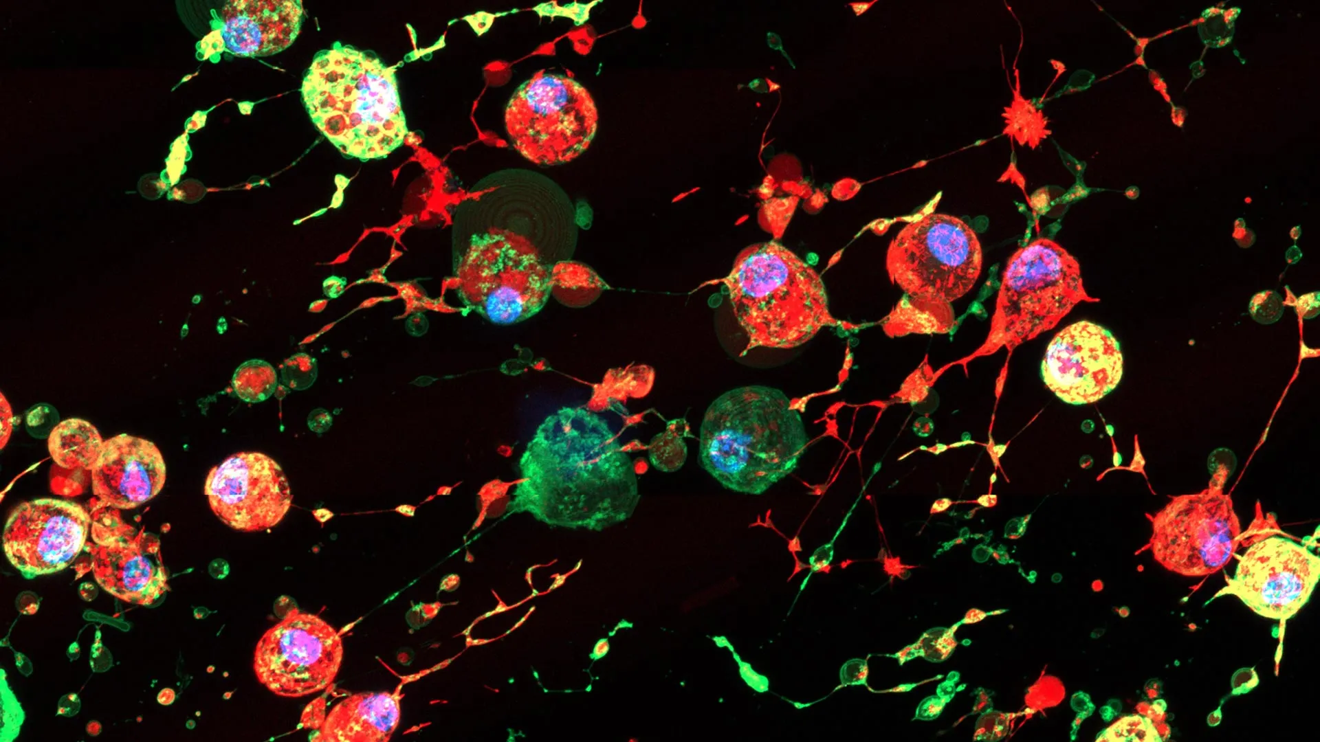 Dying Cells Leave Viral "Breadcrumb Trails" That Spread Infection