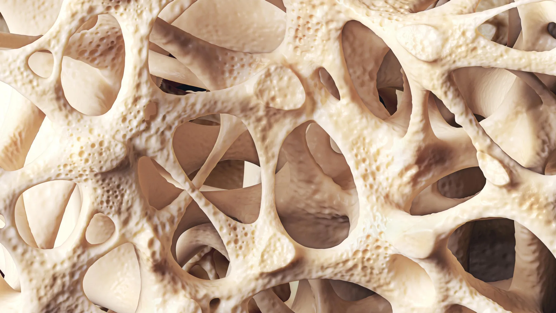 Osteopenia: The Silent Bone Loss Condition Affecting 40% of Adults